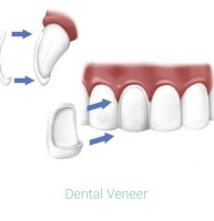 Crestline village dentistry