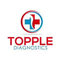Topple diagnostics