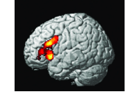 Cerebral syntax
