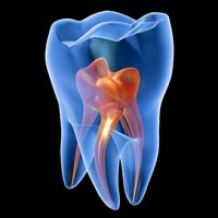 DENTES Dental Implantoloji & Estetik Klinigi