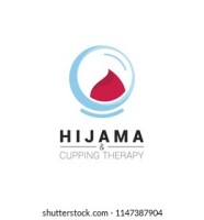 Hijama cupping