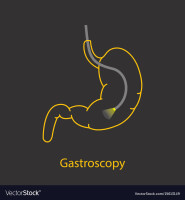 Gastroscopy