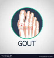 Gout international