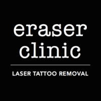 Eraser clinic laser tattoo removal
