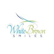 White brown smiles