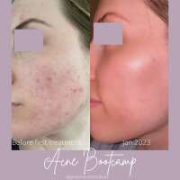 Glow Skincare & Wax