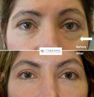 Tabanmd - oculoplastic surgery