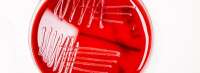 Smartfood r&d