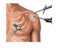 D.r Chakradhar Orthopedic Clinic in Miyapur and Madinaguda Hyderabad