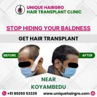 Unique Hair Grow Hair Transplant Clinic
