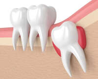 Your Trusted Partner for Comprehensive Oral Health Care in Madinaguda & Kondapur, Hyderabad