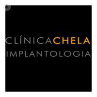Clínica chela implantología