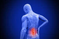 Back Pain Doctor NJ