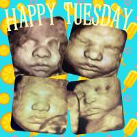 Adorable Baby 3d 4d Ultrasound Studio Danville Ca