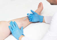Vein Treatment California