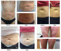 Vivo Clinic