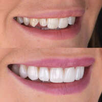 Marylebone Smile Clinic