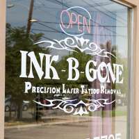 Ink-b-gone laser tattoo removal