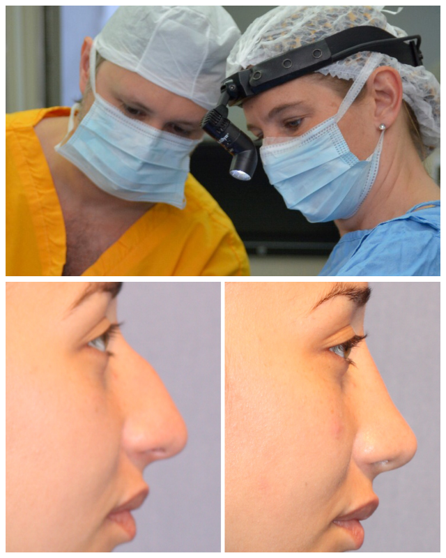 Review BENNICE Cirugía facial de última generación image 54148