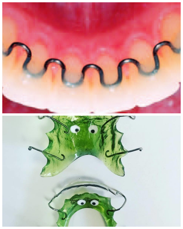 Review Ordont orthodontic appliance laboratories image 332208