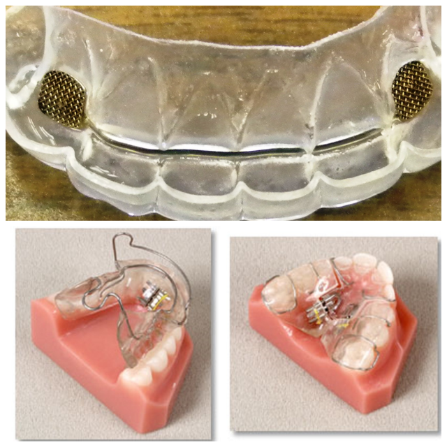 Review Ordont orthodontic appliance laboratories image 332209