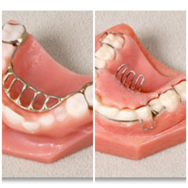Review Ordont orthodontic appliance laboratories image 332210