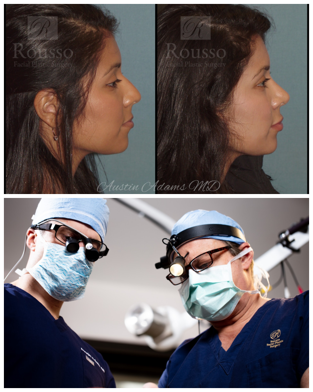 Review Rousso facial plastic surgery image 276562