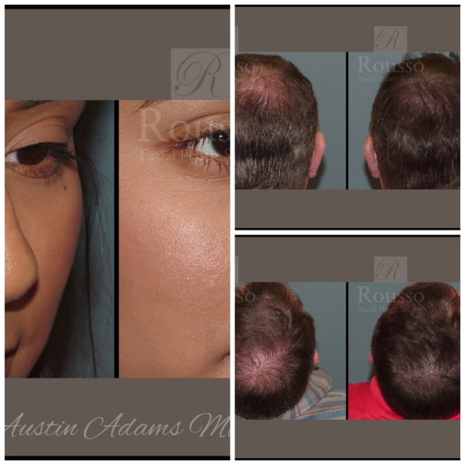 Review Rousso facial plastic surgery image 276563