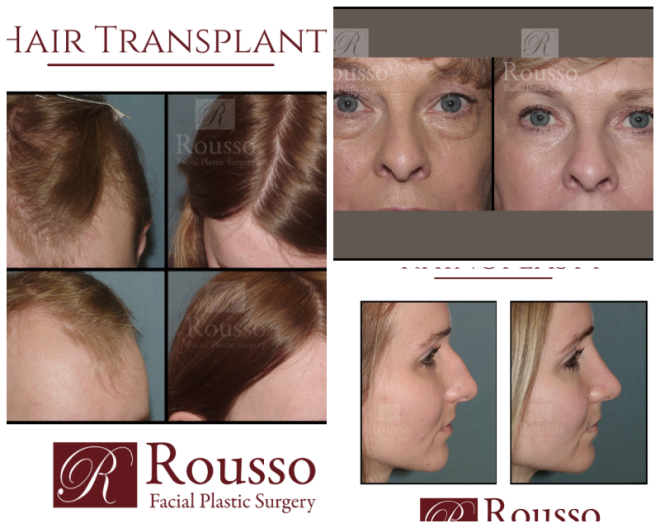 Review Rousso facial plastic surgery image 276564