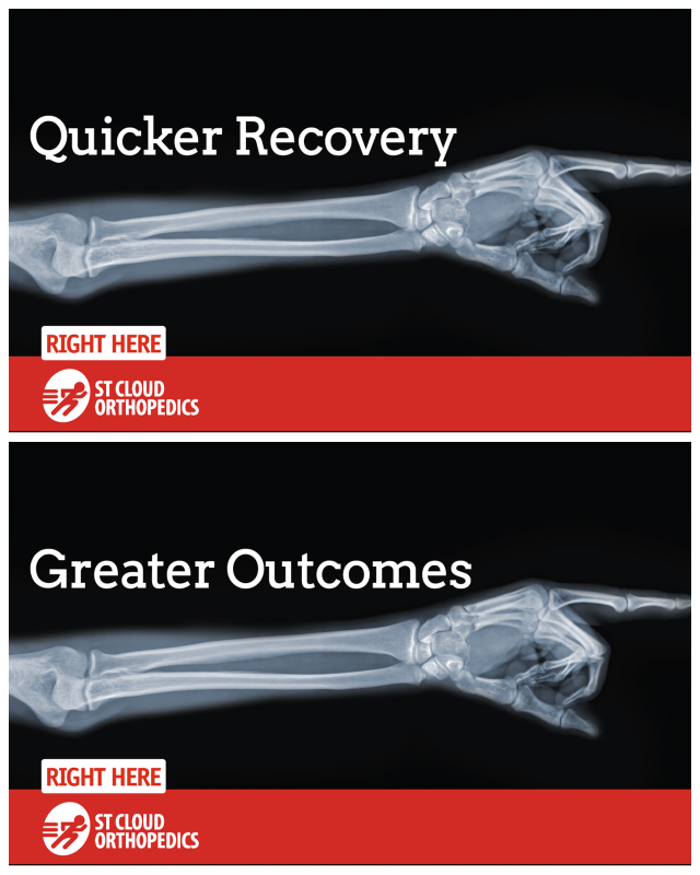 Review St. cloud orthopedics image 260841
