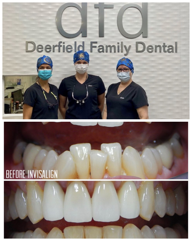 Review Deerfield family dental image 272685