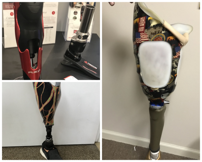 Review Limbcare prosthetics & orthotics of georgia,  inc. image 313363