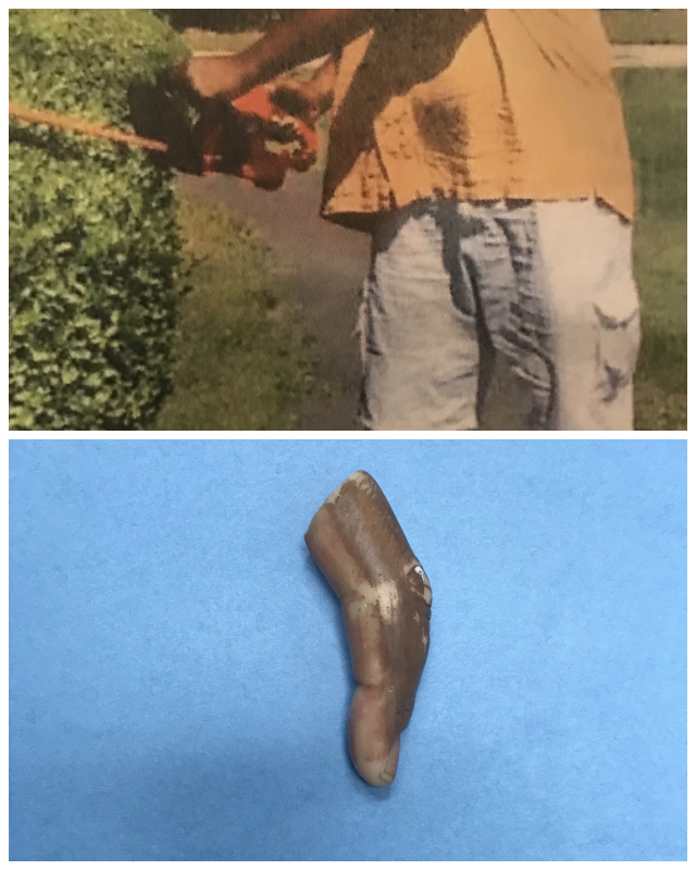 Review Limbcare prosthetics & orthotics of georgia,  inc. image 313364