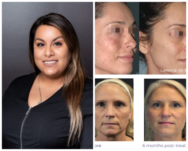 Review Alc medspa image 293474