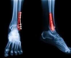 Review Orthocenter image 358720