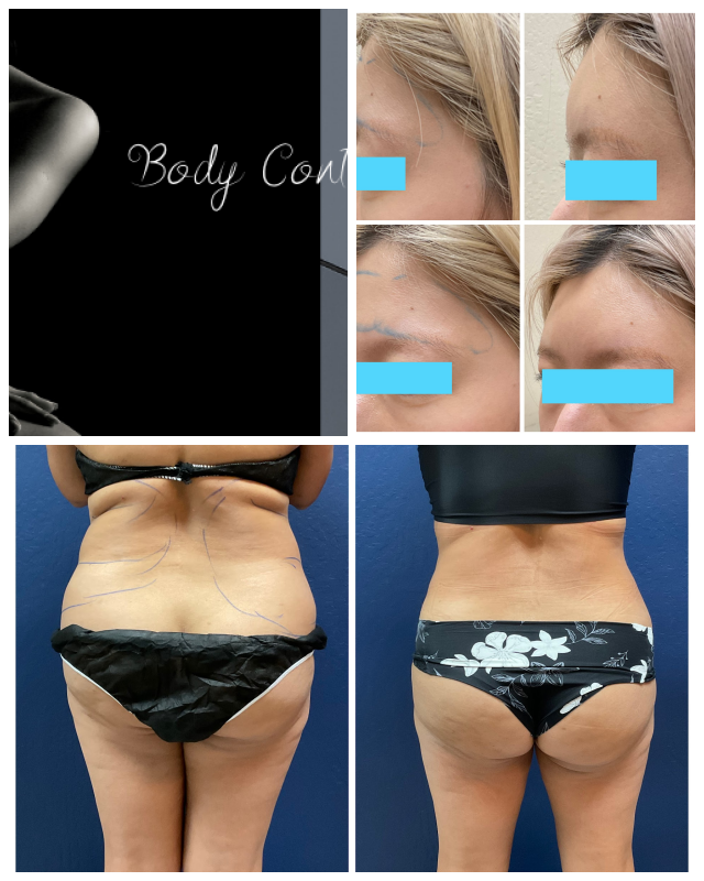 Review Cupertino Medical Laser Center image 92881
