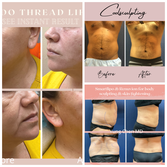 Review Cupertino Medical Laser Center image 92882