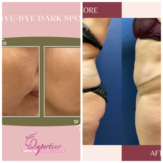 Review Cupertino Medical Laser Center image 92883