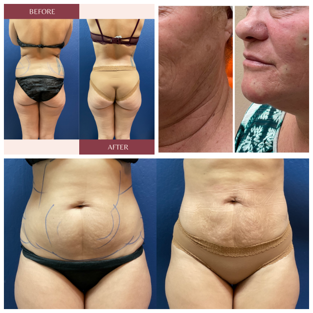 Review Cupertino Medical Laser Center image 92884