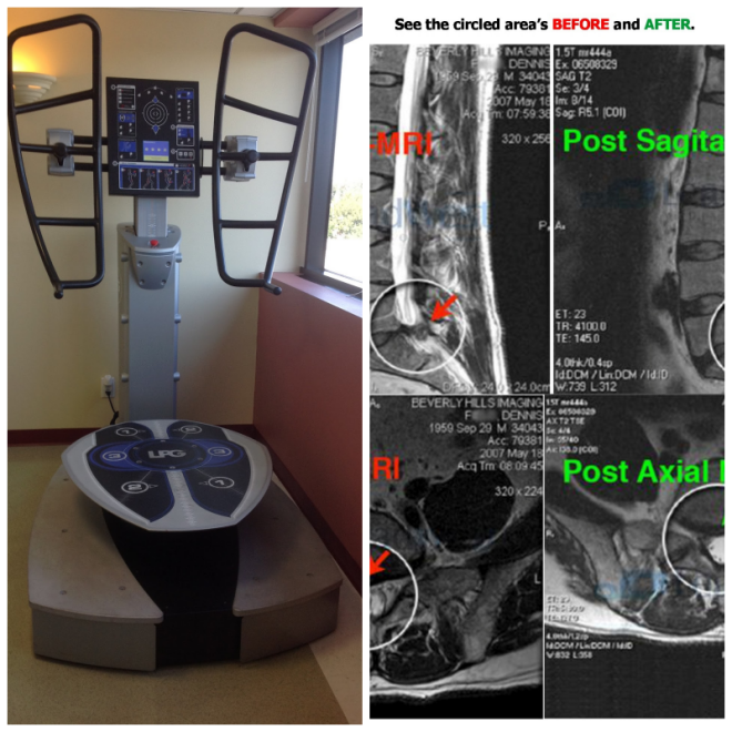 Review Valley Spinal Decompression Center image 176365