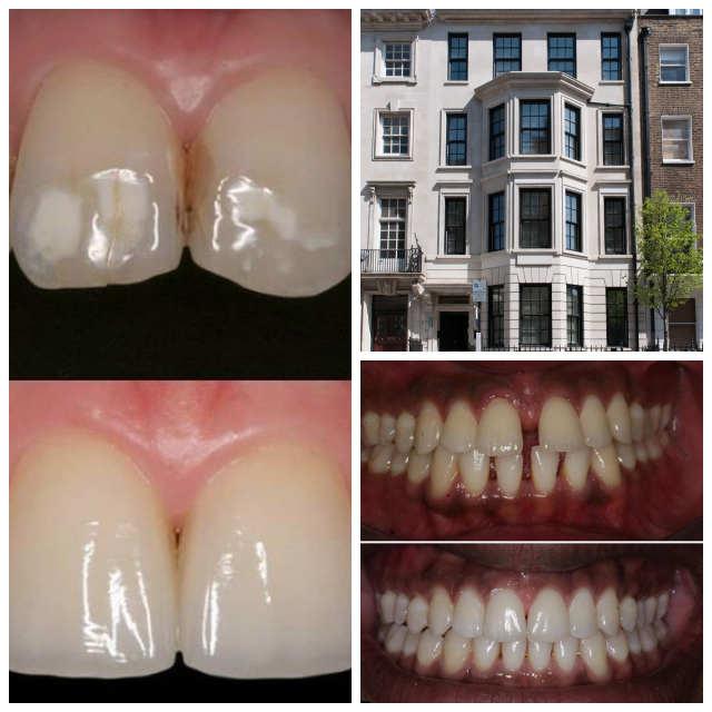 Review Harley Street Dental Studio image 231876