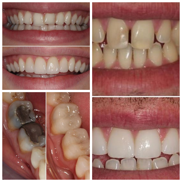 Review Harley Street Dental Studio image 231877