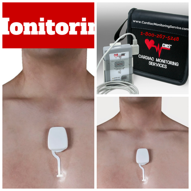 Review Cardiac Monitoring Services image 187093