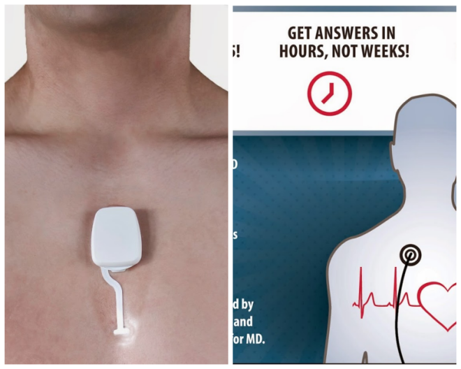 Review Cardiac Monitoring Services image 187094