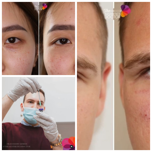Review Anti Aging Aestheticen image 119861