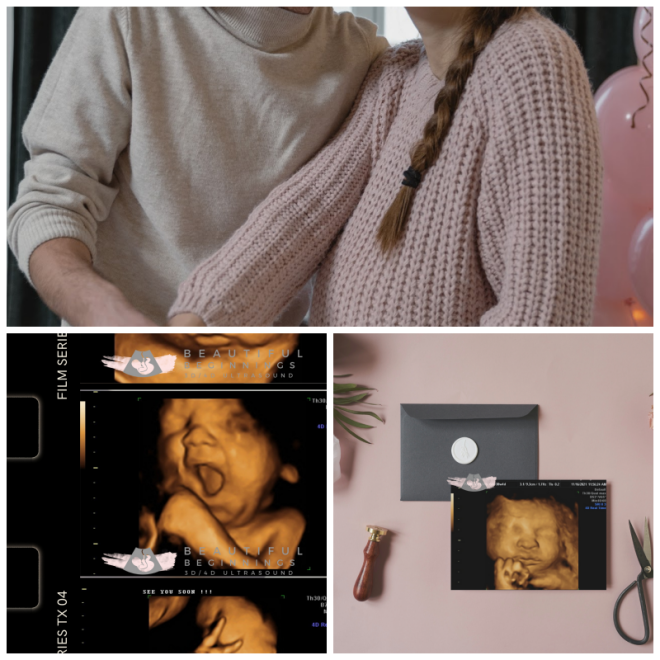 Review Beautiful Beginnings 3D 4D Ultrasound image 118751