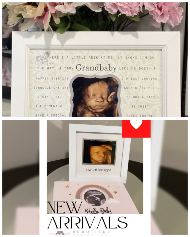 Review Beautiful Beginnings 3D 4D Ultrasound image 118753