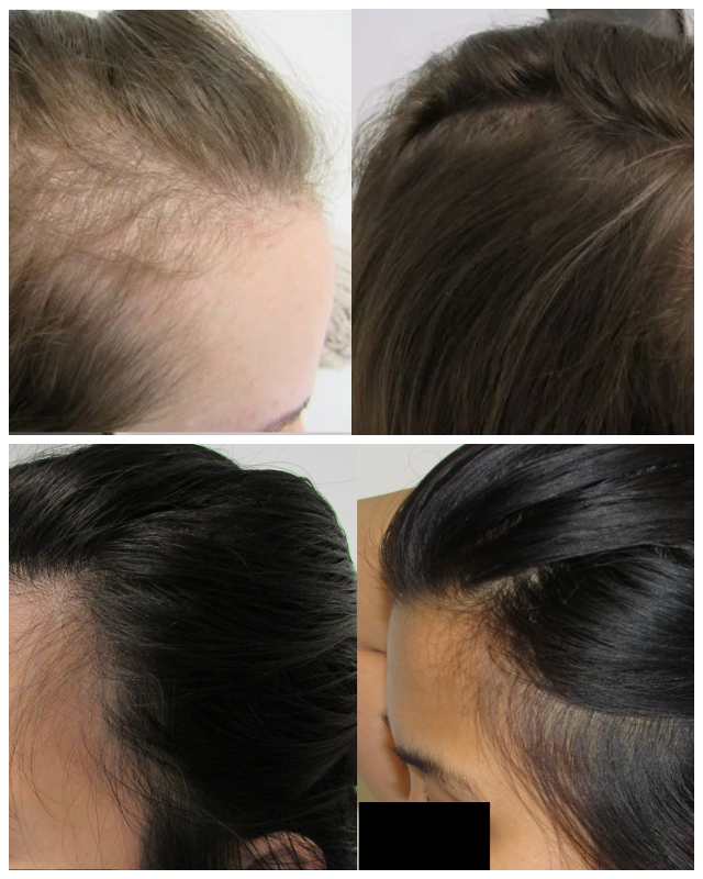 Review Stop and reGROW image 148077