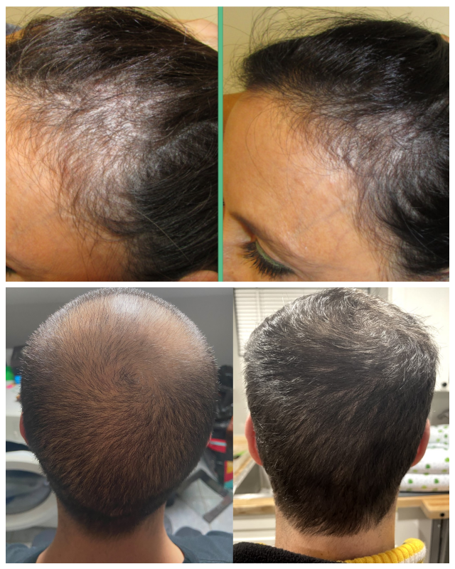 Review Stop and reGROW image 148078
