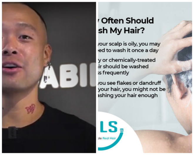 Review Innovative hair loss solutions image 300521